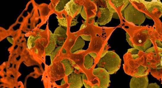 The dangers of growing antibiotic resistance
