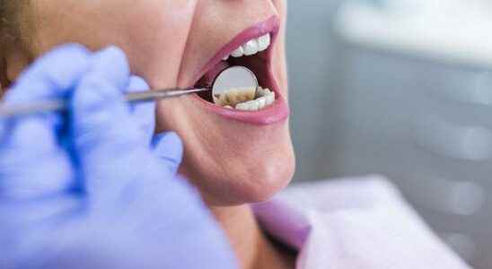 To prevent bad breath Do not neglect oral care in