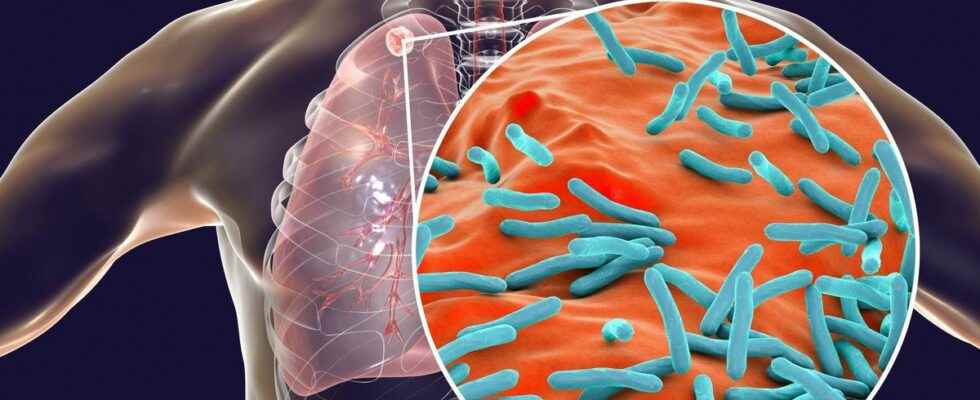 Tuberculosis more than 250 children in contact with an infected