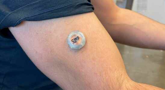 A mini sensor on the arm measures glucose alcohol and lactate