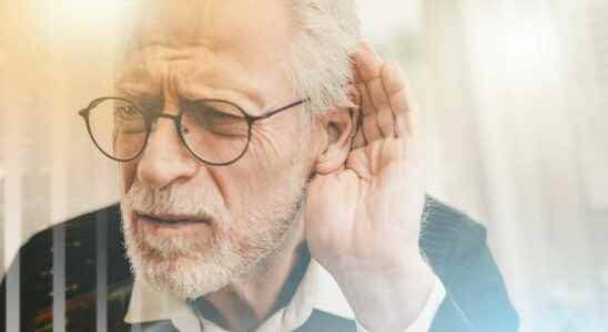 Age related hearing loss the stria vascularis involved