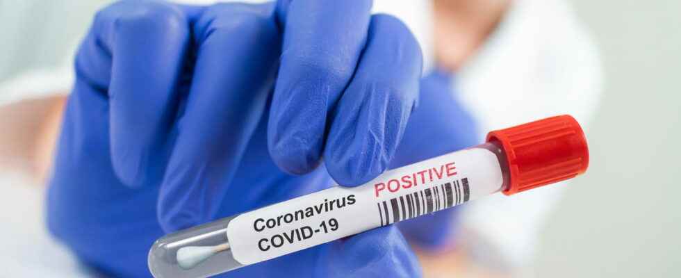 Covid France figures the epidemic is still declining on May