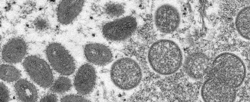 Denmark offers vaccine against monkey pox