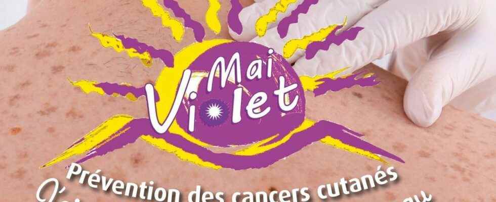 Mai Violet the operation against skin cancer