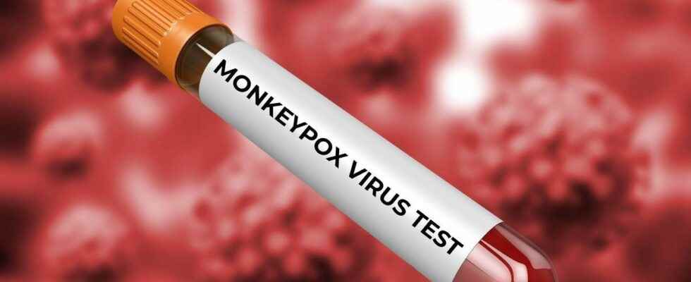 Monkey pox Roche develops PCR tests to detect the virus