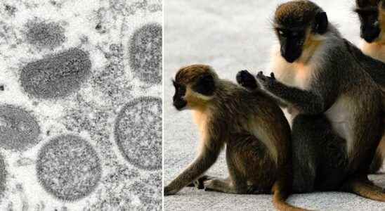 Monkey pox and Monkeypox detected in Spain Portugal UK USA
