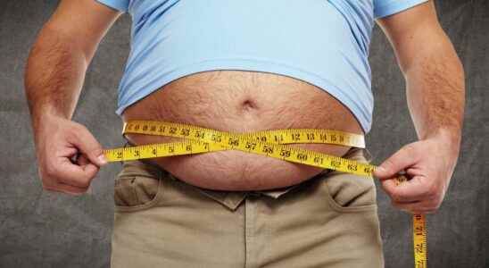 Restrictive diets do not help obese people lose weight