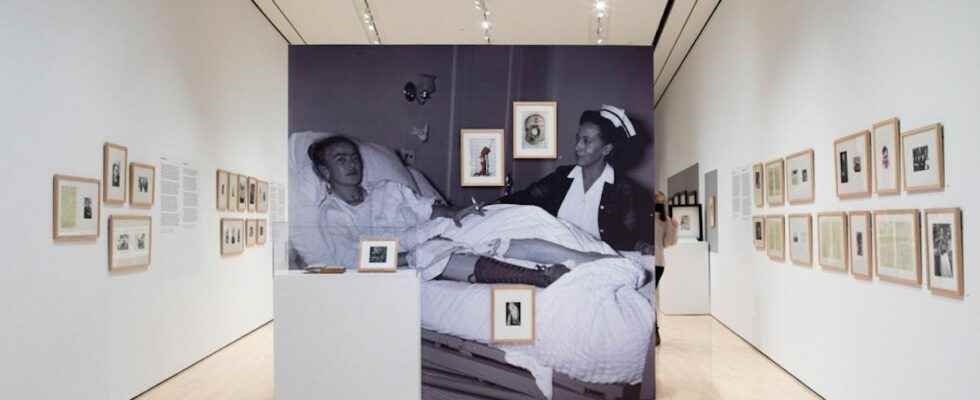 The medical journey of Frida Kahlo in an unprecedented exhibition