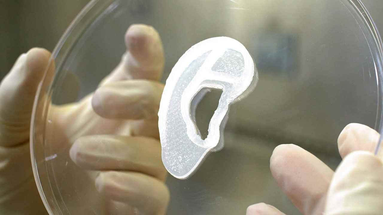 1654238386 971 A woman transplanted an ear printed using her own cells