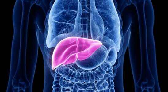 Liver cancer towards a new hierarchy in risk factors