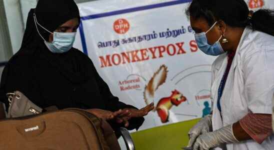 Misleading and stigmatizing the name of monkeypox should soon change
