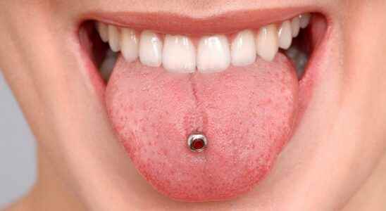 Mouth piercing a real risk for teeth and gums