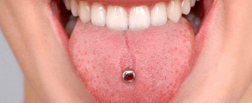 Mouth piercing a real risk for teeth and gums