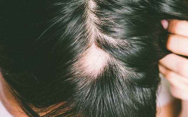 Three hair care habits responsible for hair loss