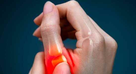 Thumb osteoarthritis botulinum toxin effective against pain