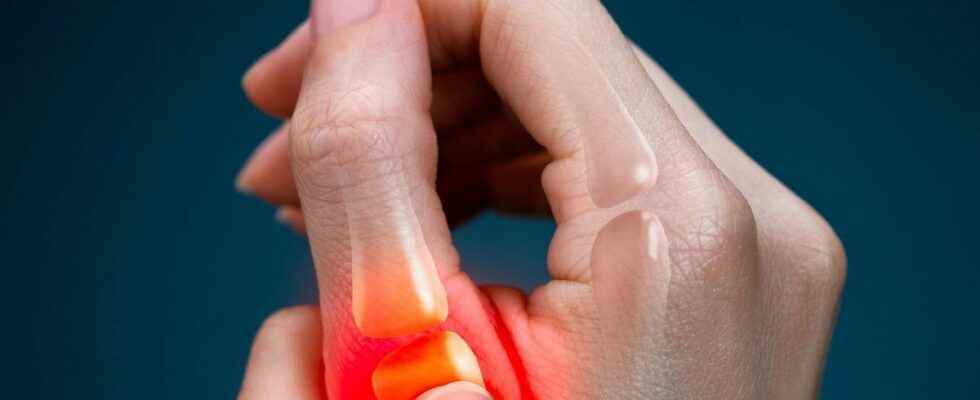 Thumb osteoarthritis botulinum toxin effective against pain