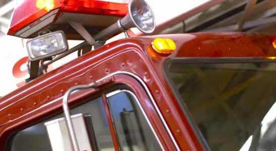 Woman suffers severe burns in kitchen fire