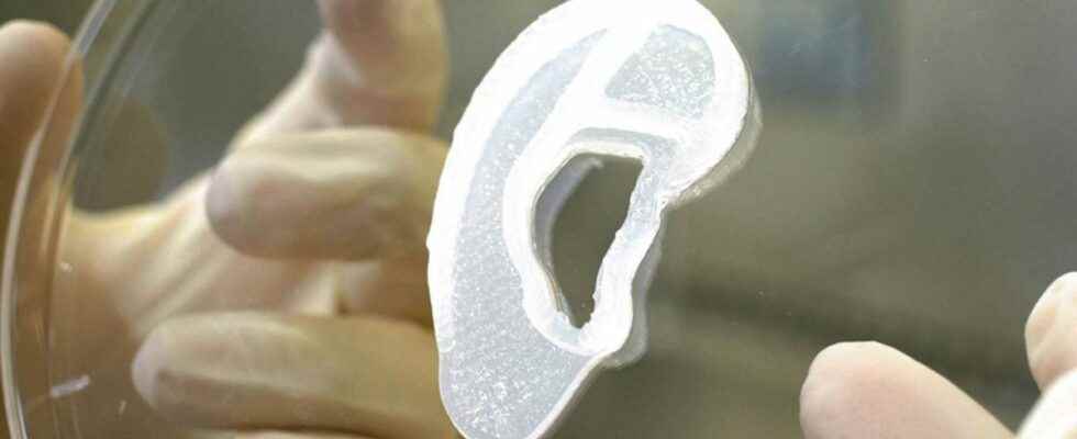 Worlds first human ear implant transplant created by 3D printer
