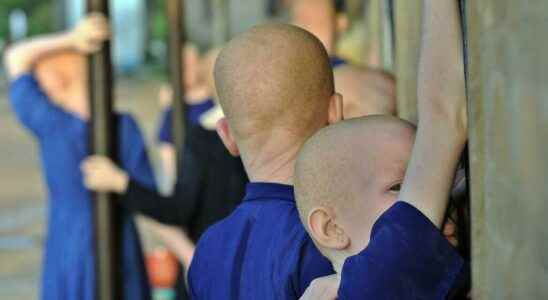 spared from ritual crimes albinos remain strongly discriminated against