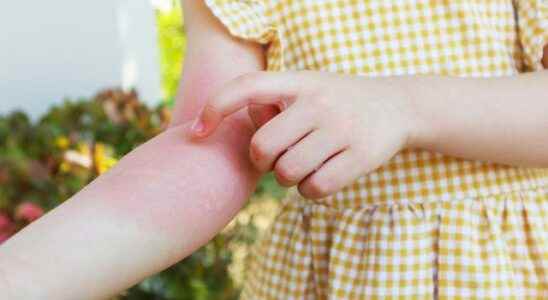8 important symptoms of rheumatic diseases in children