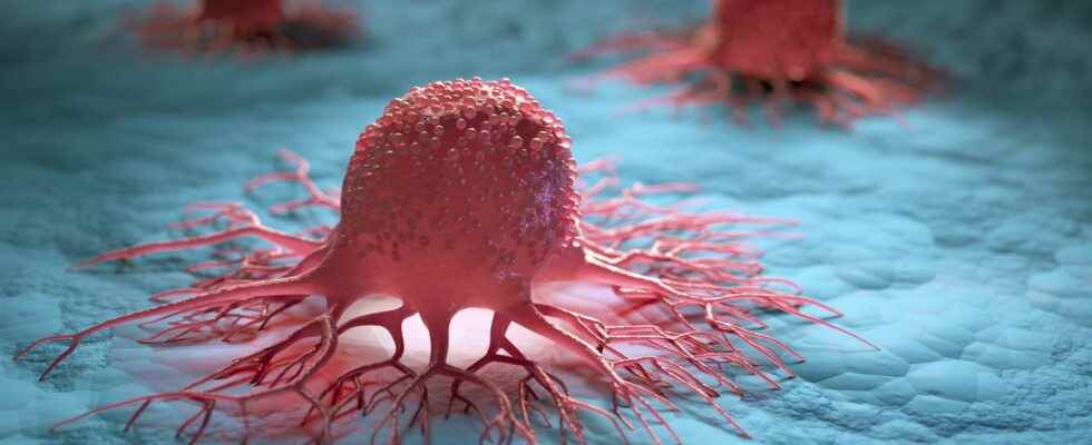 Cancer a blood test to determine the preferred treatment