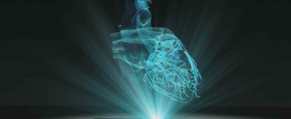 For the first time doctors train on a hologram