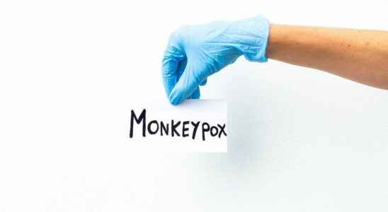 Monkey pox no evidence that the virus is transmitted through