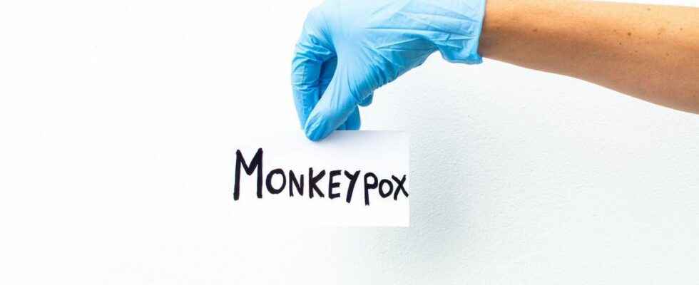 Monkey pox no evidence that the virus is transmitted through