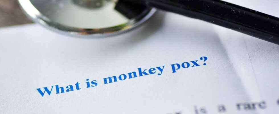 Monkey pox symptoms not always identical in all patients