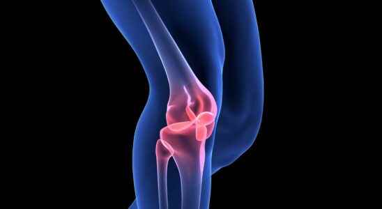Septic arthritis what is it