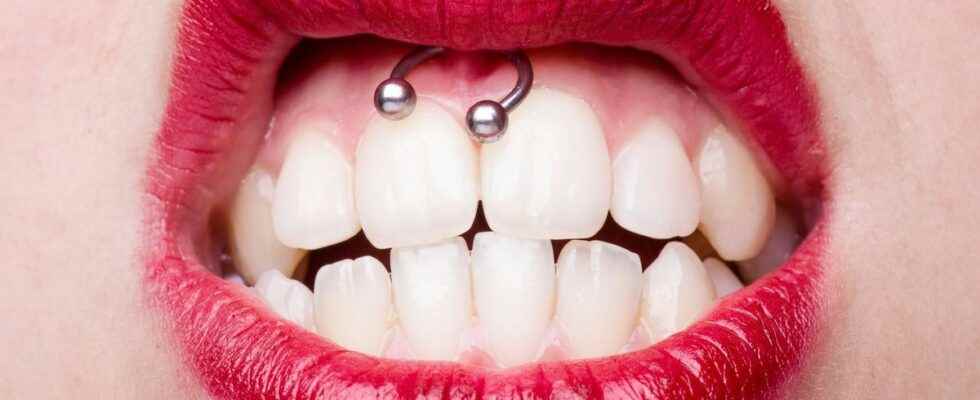 The smiley piercing does not make orthodontists laugh
