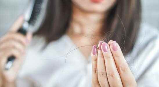 What are the causes of hair loss in men and