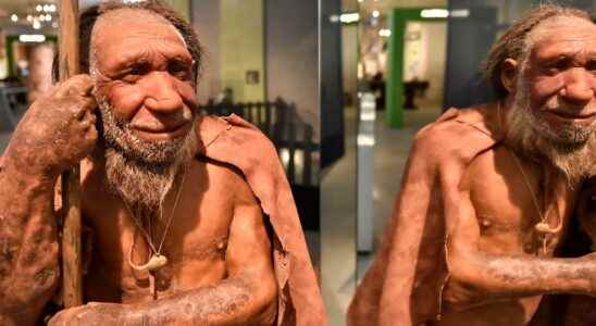 Lower medicine dose if you are more Neanderthal
