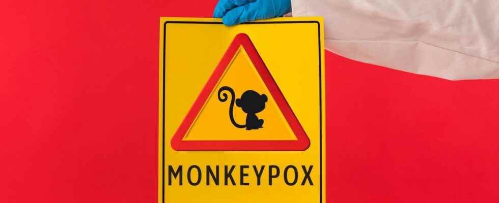 Monkey pox a second infected patient dies in Spain