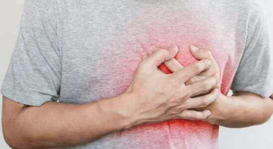 Natural remedies for heart palpitations What are the symptoms why
