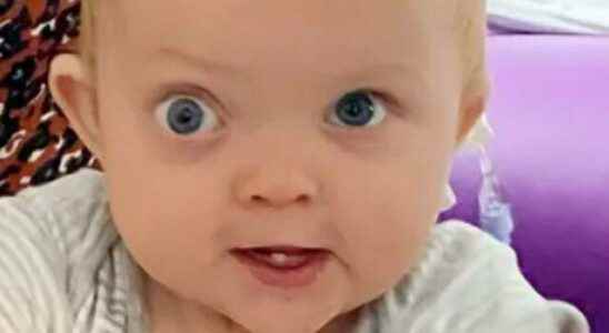 Parents warned The change she noticed in her babys eyes