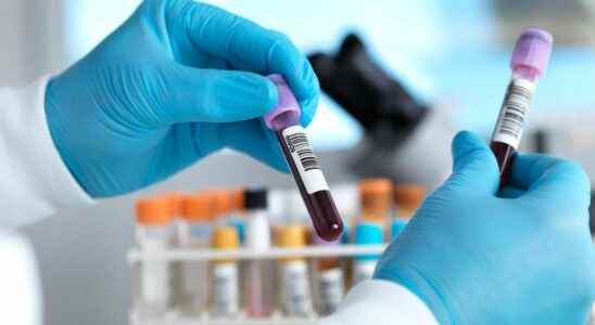 A blood test would allow the early detection of more