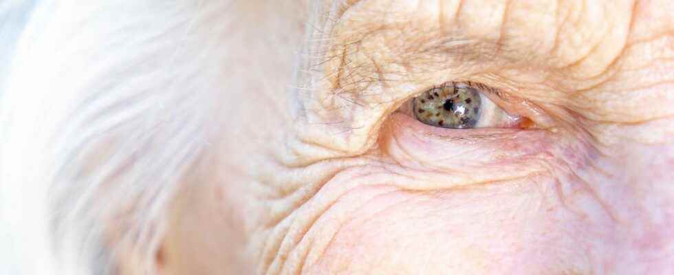 AMD a protein responsible for age related vision loss
