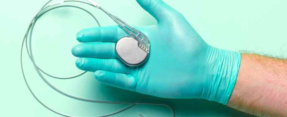 Alert Faulty pacemakers reported more than 16000 French people concerned