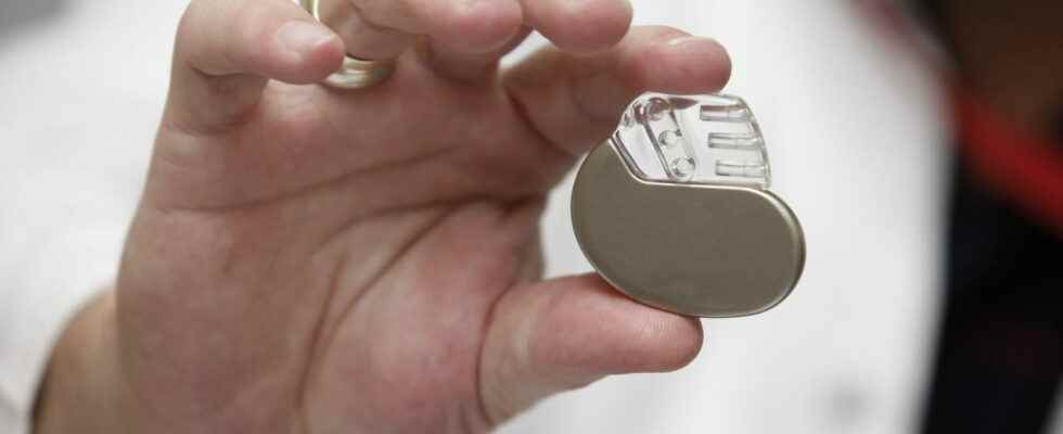 Failing Abbott pacemakers models 16300 French people concerned