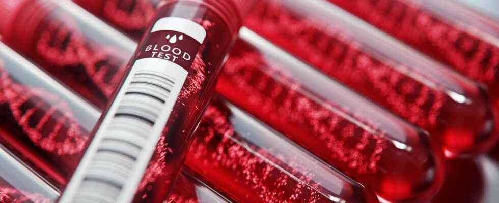 People with blood group A are more likely to have