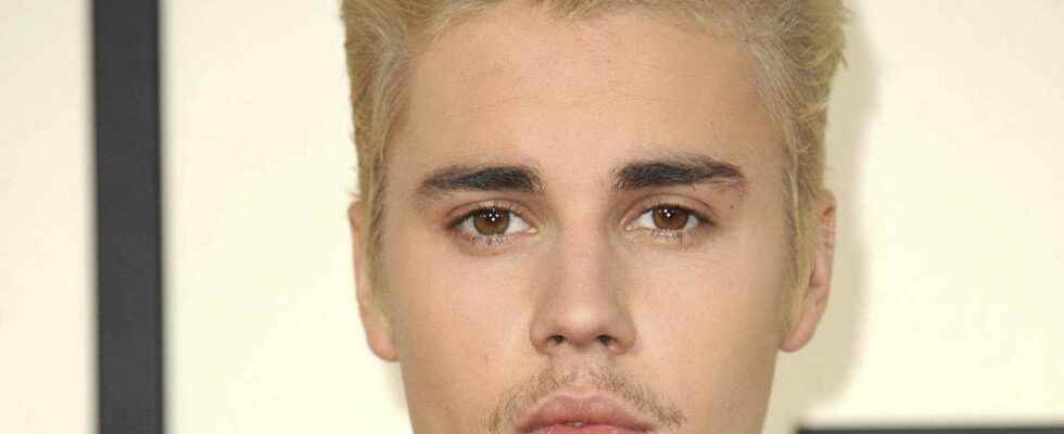 Ramsay Hunt syndrome Justin Bieber stops his tour
