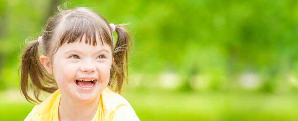 Trisomy 21 a promising hormone based therapy improves cognitive functions