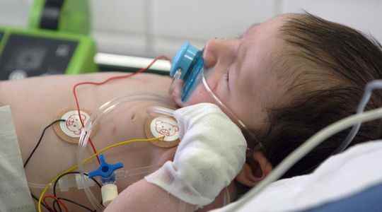 Early the bronchiolitis epidemic starts very quickly and very strong
