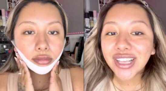 Say goodbye to your double chin