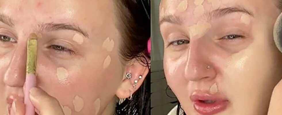The sticky method the trendy technique to camouflage your acne