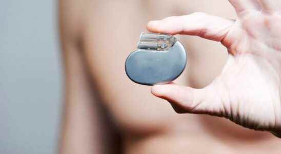 A wireless and batteryless pacemaker soon on the market