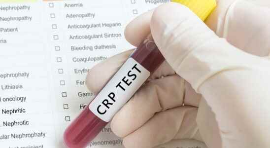 C reactive protein CRP high low norm which test