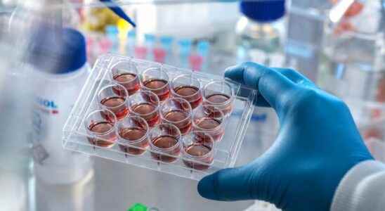 For the first time laboratory grown blood cells transfused into humans