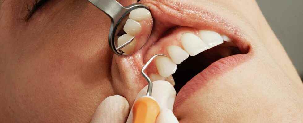 Oral diseases affect nearly half of the worlds population